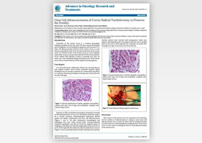 Clear Cell Adenocarcinoma of Cervix: Radical Trachelectomy to Preserve the Fertility