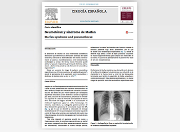 Marfan syndrome and pneumothorax