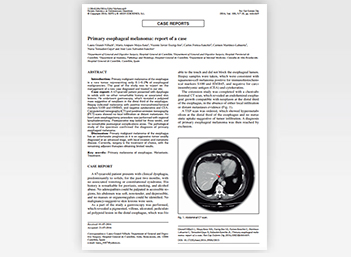 Primary esophageal melanoma: report of a case